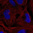 Anti-ZNF616 Antibody