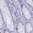 Immunohistochemical staining of human colon shows strong cytoplasmic positivity in lymphocytes.