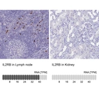 Immunohistochemistry analysis in human lymph node and kidney tissues using HPA062657 antibody. Corresponding IL2RB RNA-seq data are presented for the same tissues.