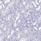 Immunohistochemical staining of human kidney shows no positivity in cells in tubules as expected.