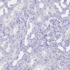 Immunohistochemical staining of human kidney shows no positivity in cells in tubules as expected.