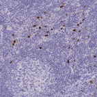 Immunohistochemical staining of human lymph node shows strong cytoplasmic positivity in lymphocytes.