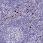 Immunohistochemical staining of human lymph node shows strong cytoplasmic positivity in lymphocytes.