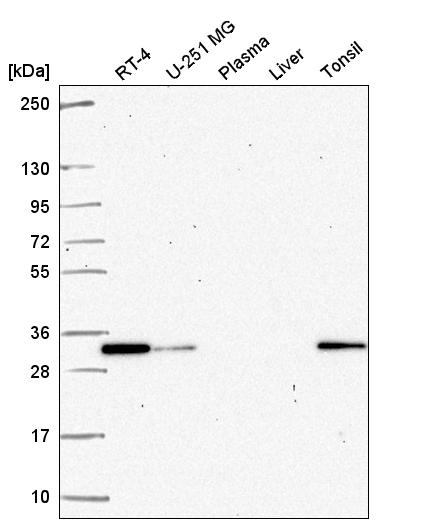 Anti-PSME2 Antibody