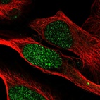 Immunofluorescent staining of human cell line U-2 OS shows localization to nucleus.