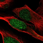 Immunofluorescent staining of human cell line U-2 OS shows localization to nucleus.