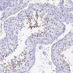 Immunohistochemical staining of human testis shows high expression.