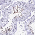 Anti-BPIFA3 Antibody