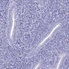 Immunohistochemical staining of human endometrium shows low expression as expected.