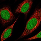 Immunofluorescent staining of human cell line SiHa shows localization to nucleoplasm.