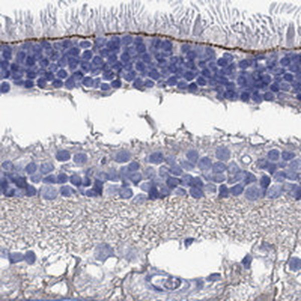 Anti-TMEM221 Antibody