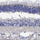 Anti-TMEM221 Antibody