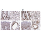 Anti-EWSR1 Antibody