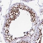 Immunohistochemical staining of human testis shows strong nuclear positivity in cells in seminiferous ducts.
