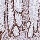 Immunohistochemical staining of human rectum shows strong nuclear positivity in glandular cells.