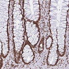 Immunohistochemical staining of human rectum shows strong nuclear positivity in glandular cells.