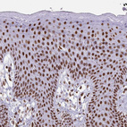 Immunohistochemical staining of human skin shows strong nuclear positivity in squamous epithelial cells.