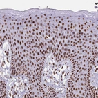 Immunohistochemical staining of human skin shows strong nuclear positivity in squamous epithelial cells.