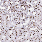 Immunohistochemical staining of human kidney shows strong nuclear positivity in cells in tubules.