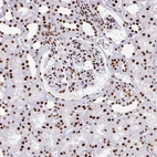 Immunohistochemical staining of human kidney shows strong nuclear positivity in cells in tubules.