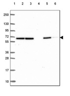 Lane 1: Marker [kDa] 250, 130, 95, 72, 55, 36, 28, 17, 10_br/_Lane 2: Human cell line RT-4_br/_Lane 3: Human cell line U-251 MG_br/_Lane 4: Human plasma_br/_Lane 5: Human Liver tissue_br/_Lane 6: Human Tonsil tissue