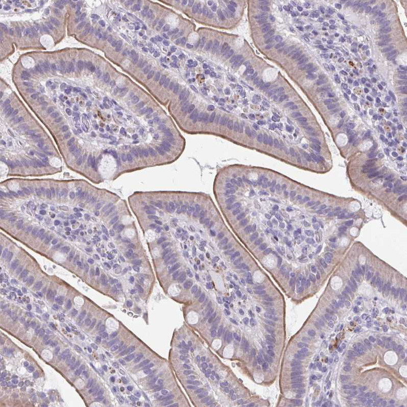 Anti-TMEM92 Antibody