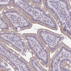 Anti-TMEM92 Antibody