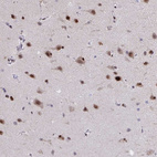 Anti-JUND Antibody