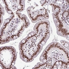 Immunohistochemical staining of human duodenum shows strong nuclear positivity in glandular cells.
