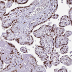 Immunohistochemical staining of human placenta shows strong nuclear positivity in trophoblastic cells.