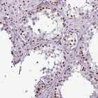 Immunohistochemical staining of human testis shows strong nuclear positivity in cells in seminiferous ducts.