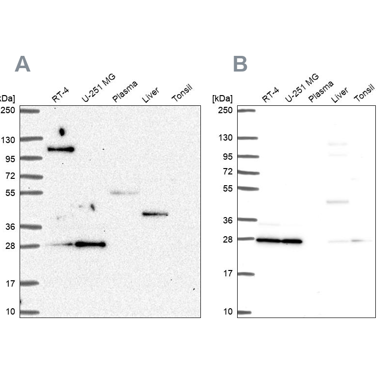 Anti-POLR2E Antibody