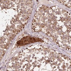 Anti-PDHA1 Antibody