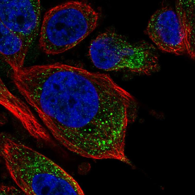Anti-TPRG1L Antibody