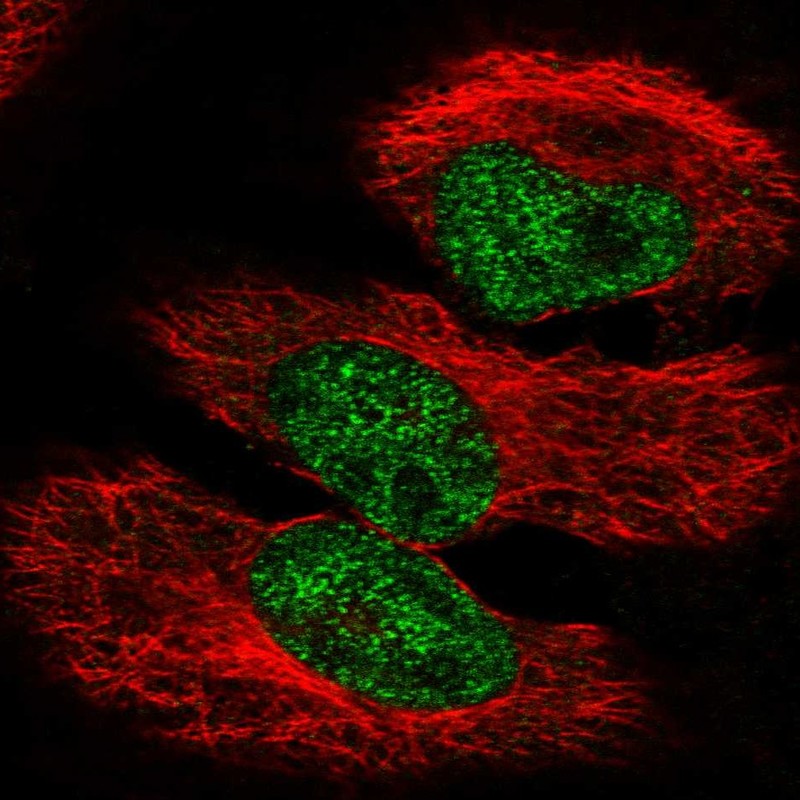 Anti-PPARGC1A Antibody