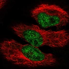 Anti-PPARGC1A Antibody