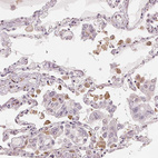 Anti-IL9R Antibody