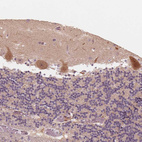 Immunohistochemical staining of human cerebellum shows strong cytoplasmic positivity in Purkinje cells.