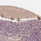 Immunohistochemical staining of human cerebellum shows strong cytoplasmic positivity in Purkinje cells.