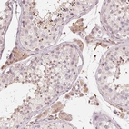 Immunohistochemical staining of human testis shows moderate cytoplasmic positivity in Leydig cells.