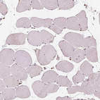Immunohistochemical staining of human skeletal muscle shows no cytoplasmic positivity in myocytes as expected.