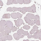 Immunohistochemical staining of human skeletal muscle shows no cytoplasmic positivity in myocytes as expected.