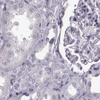 Immunohistochemical staining of human kidney using Anti-TCHHL1 antibody HPA063483.