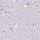 Immunohistochemical staining of human cerebral cortex using Anti-TCHHL1 antibody HPA063483.