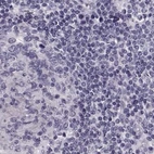 Immunohistochemical staining of human lymph node using Anti-TCHHL1 antibody HPA063483.