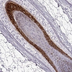 Immunohistochemical staining of human skin, hairy using Anti-TCHHL1 antibody HPA063483.
