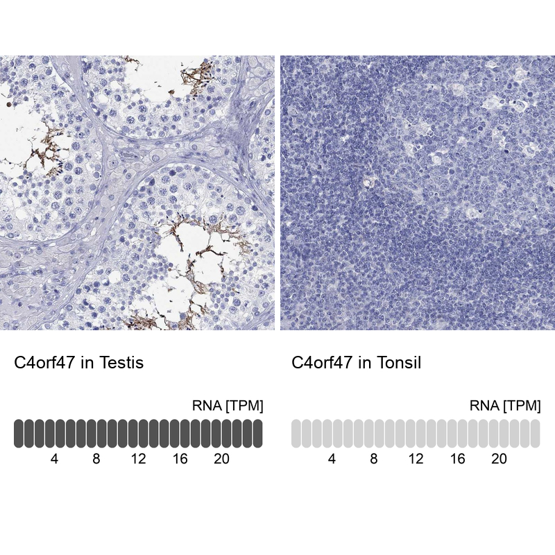 Anti-C4orf47 Antibody
