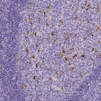 Immunohistochemical staining of human tonsil shows strong cytoplasmic positivity in germinal center cells.