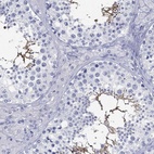 Immunohistochemical staining of human testis shows high expression.