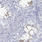 Immunohistochemical staining of human testis shows high expression.